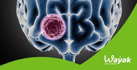 Early Symptoms of a Brain Tumor Wayak